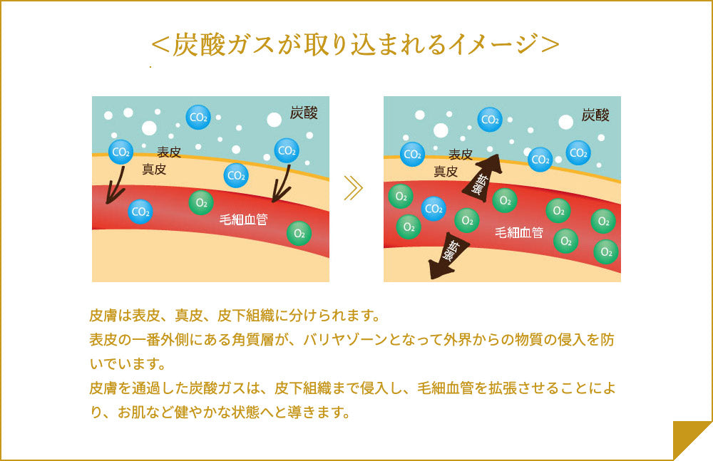 ソーダスパフォーム プレミアム 10,000(泡パック)